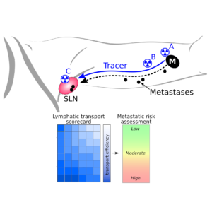 Intraoperative diagnostics of metastatic potential in melanoma